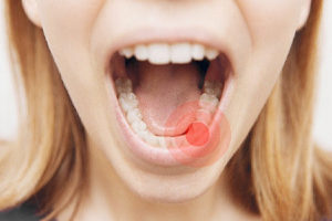 A woman with a toothache.
