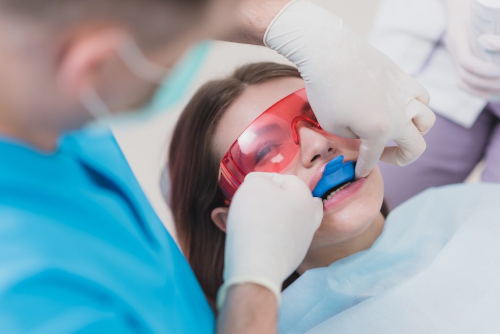 Closeup of patient getting fluoride treatment