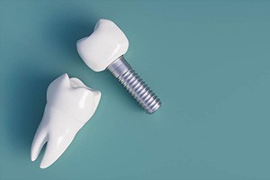 dental implants against a green background